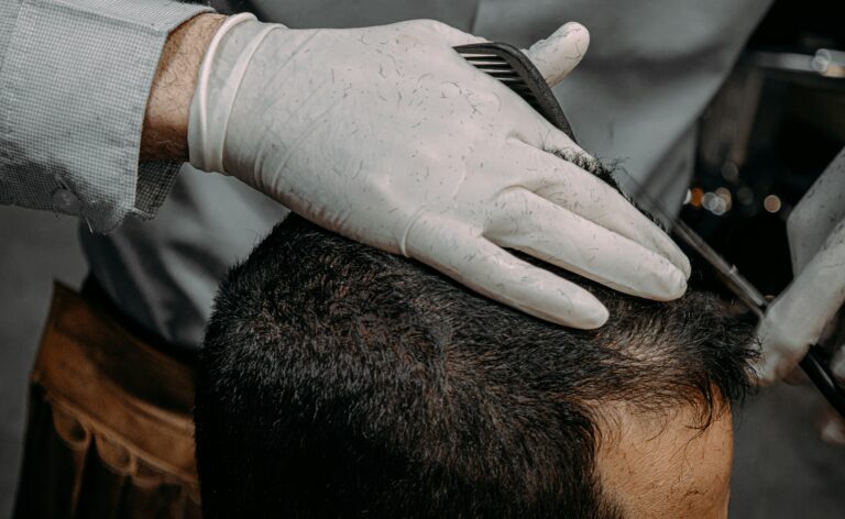 hair transplant