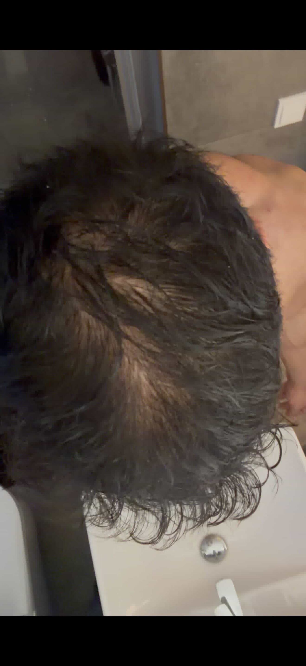 BA 3 - Before treatment