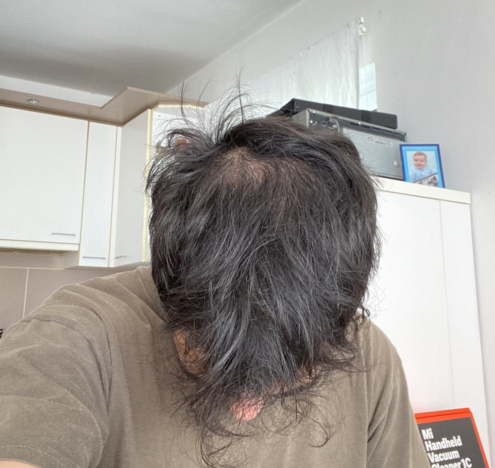 BA 6 - Before treatment