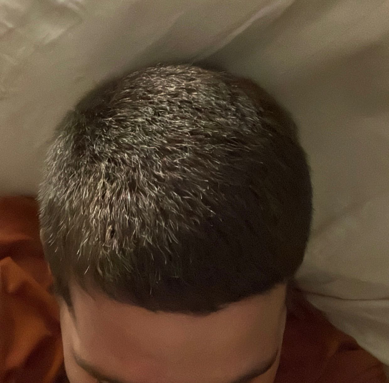 BA 9 - After treatment