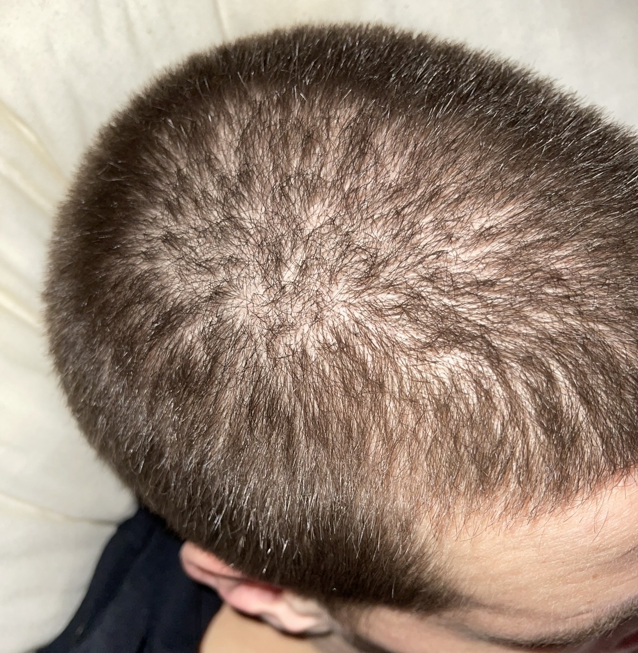 BA 9 - Before treatment