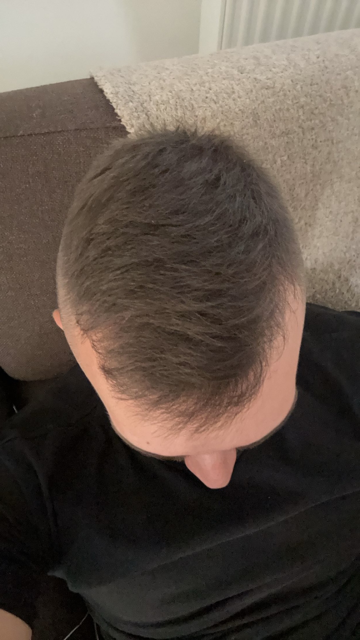 BA 10 - Before treatment
