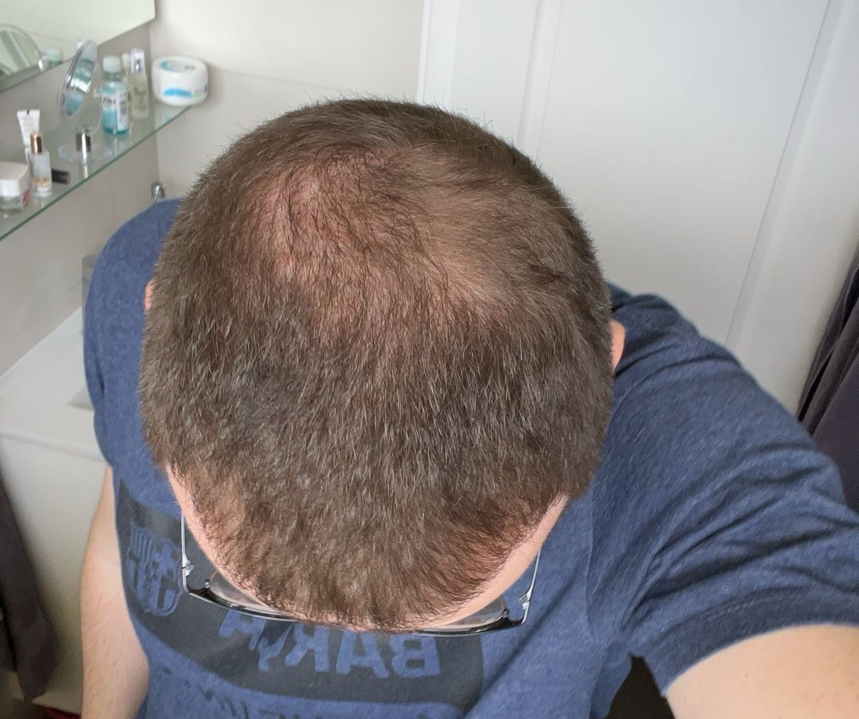 BA 12 - Before treatment
