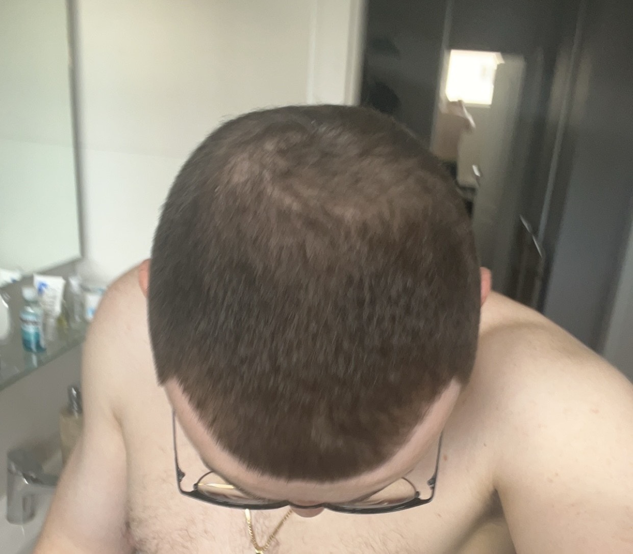 BA 12 - After treatment