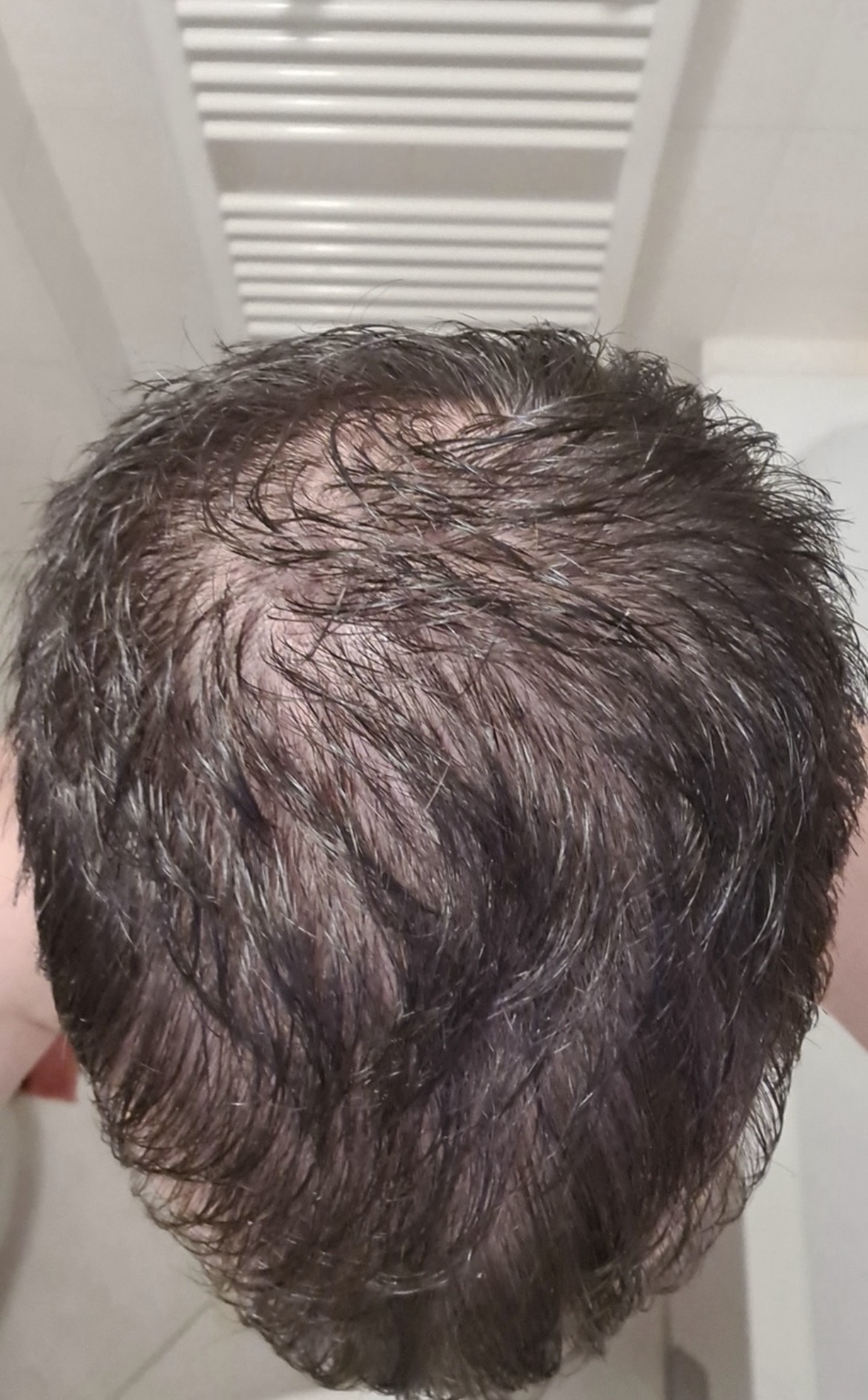 BA 8 - Before treatment