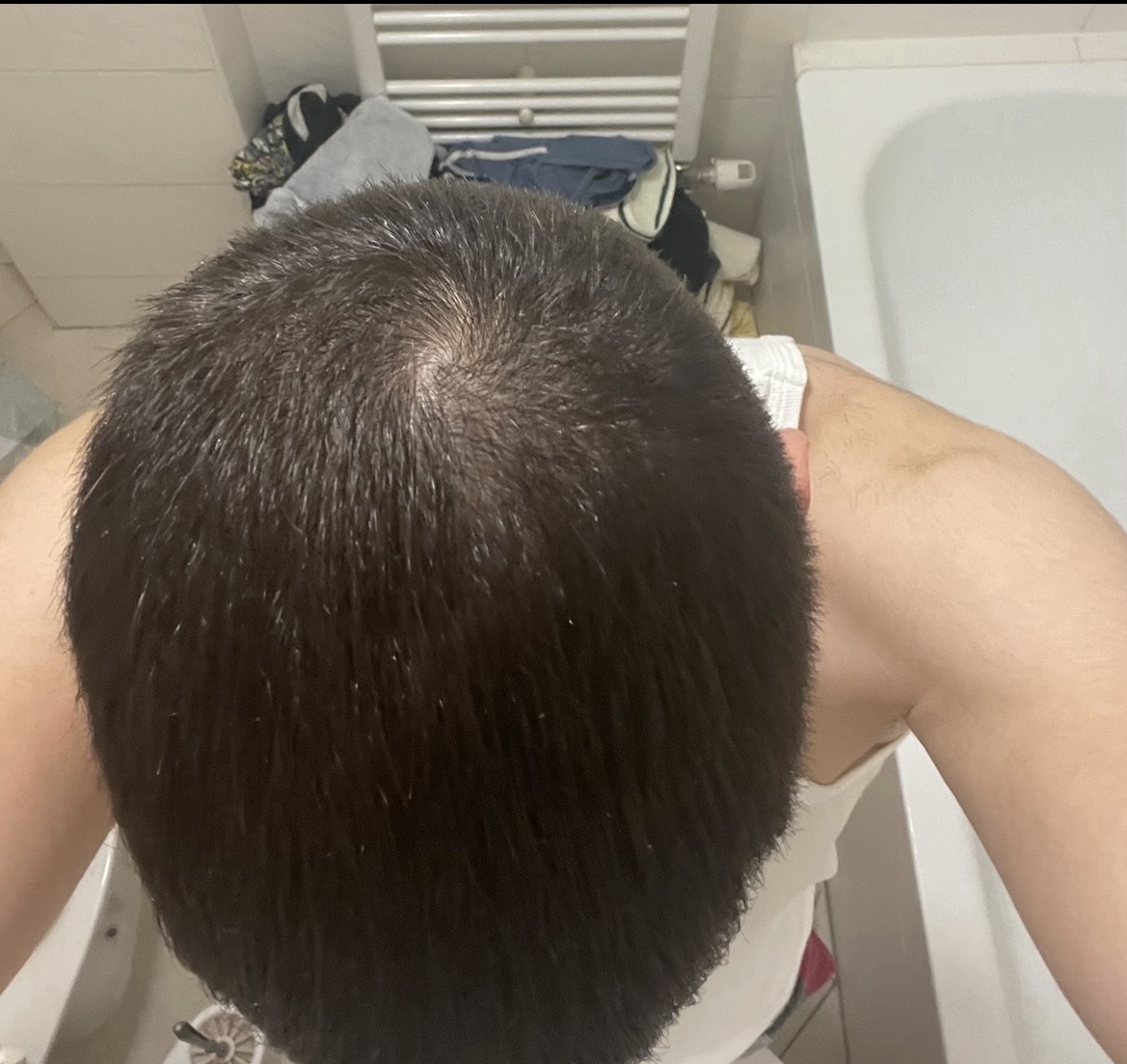 BA 8 - After treatment