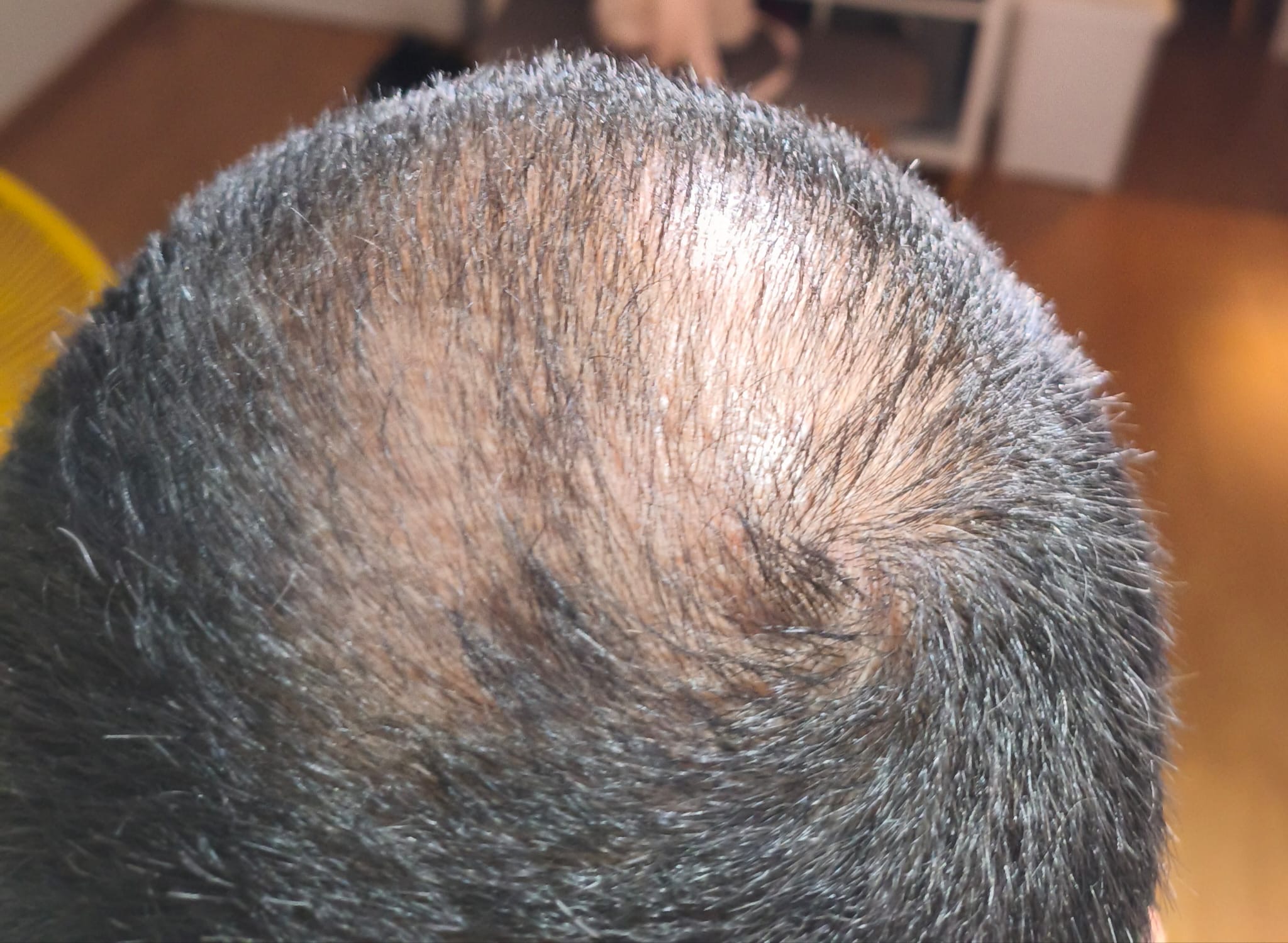 BA 4 - Before treatment