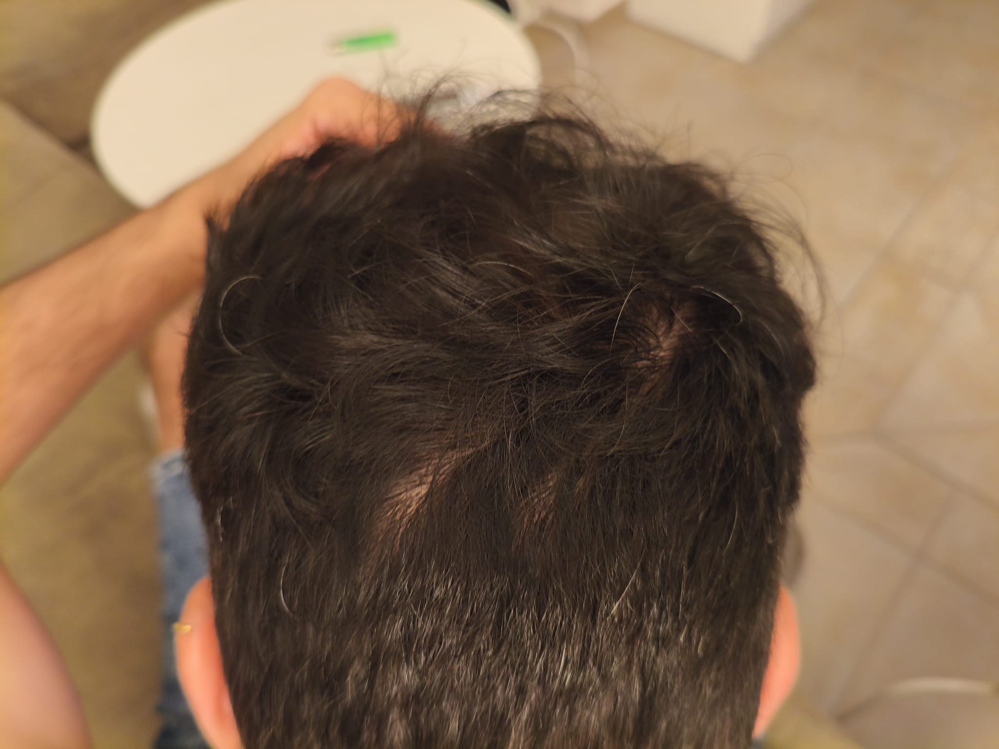 BA 4 - After treatment