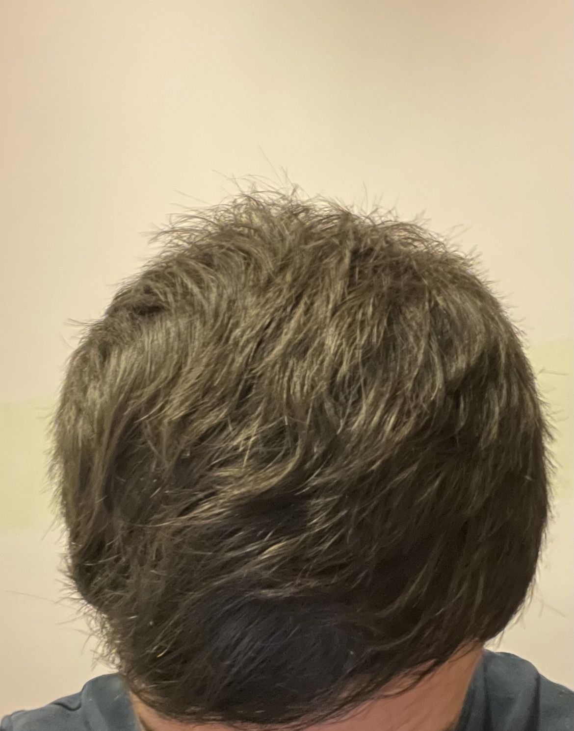 BA 13 - After treatment