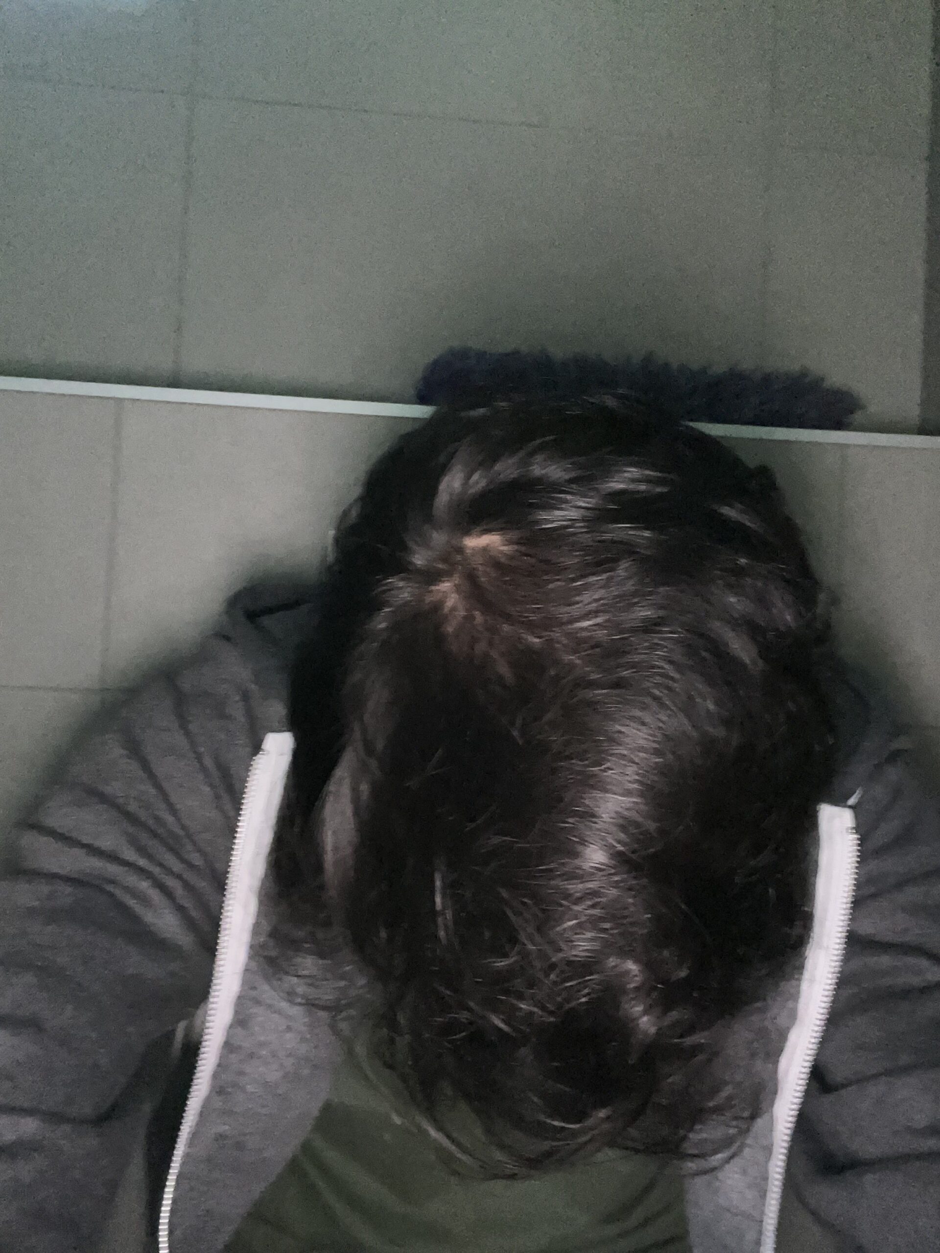 B/A 2 - After treatment